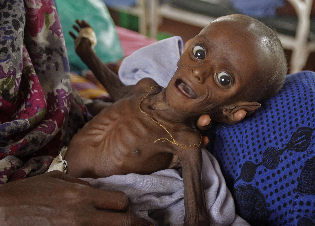 Baby victim of Somalia famine
